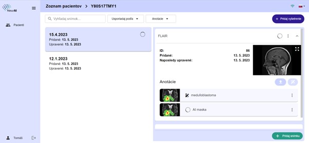 NeurAI – inteligentný asistent pre neurochirurgov