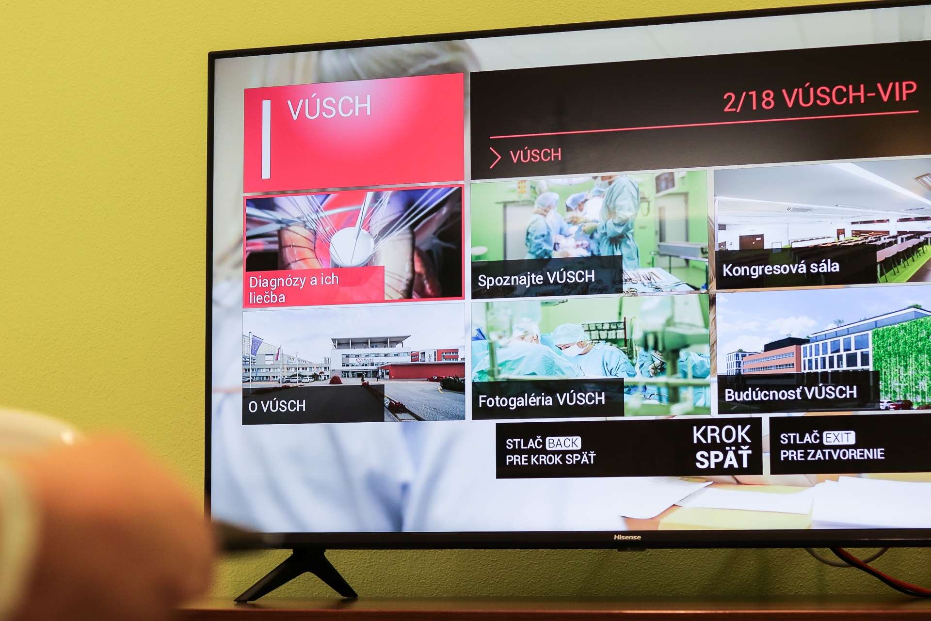 V košickom VÚSCH spustili interaktívny TV systém na izbách pacientov