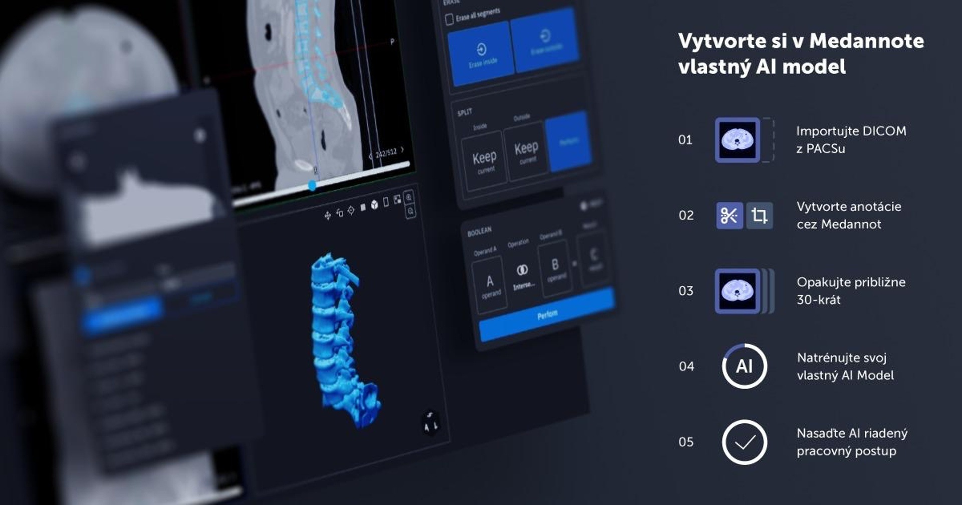 Slovenská platforma Medannot na automatizáciu rádiologických vyšetrení vďaka AI získala investíciu vo výške 300-tisíc eur